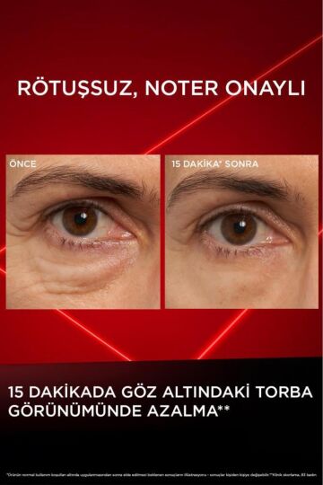 L'Oreal Paris Revitalift Lazer Eyebag Instant Eraser Göz Altı Torba Görünümüne Karşı Göz Kremi 15ml - 2