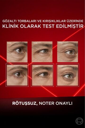 L'Oreal Paris Revitalift Lazer Eyebag Instant Eraser Göz Altı Torba Görünümüne Karşı Göz Kremi 15ml - 5