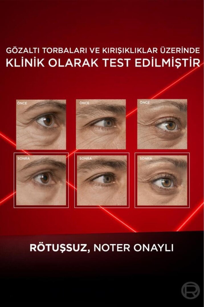 L'Oreal Paris Revitalift Lazer Eyebag Instant Eraser Göz Altı Torba Görünümüne Karşı Göz Kremi 15ml - 5