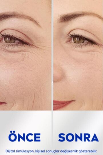 NIVEA Q10 Anında Etkili Kırışıklık Karşıtı Serum 15ml, İnce Çizgi ve Derin Kırışıklık Karşıtı - 4